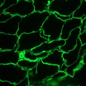 Figure 2. Immunofluorescence staining of frozen sections from pig striated skeletal muscle (methanol fixed) using MUB1100P, showing the localization of laminin in the connective tissue and in basement membranes surrounding the myofibrils.